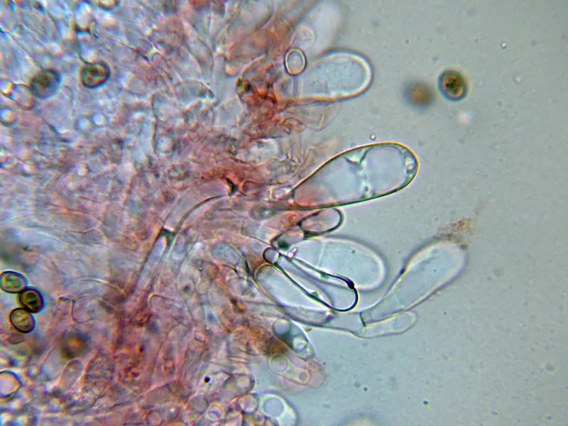 Agaricus bisporus 10 - Queilocistidios-003